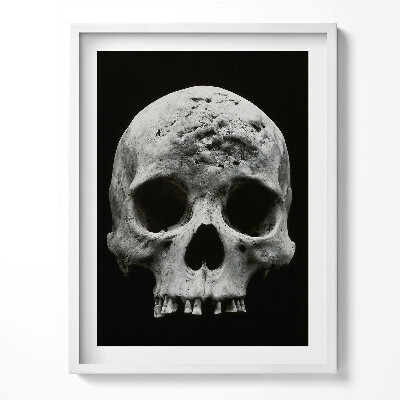 Keretezett kép Emberi koponya csontváz