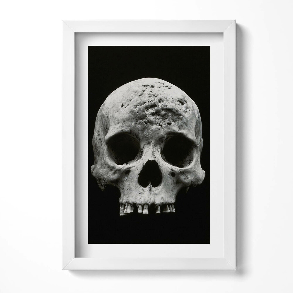 Keretezett kép Emberi koponya fekete háttérrel